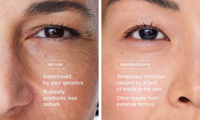 DRY OR DEHYDRATED SKIN?