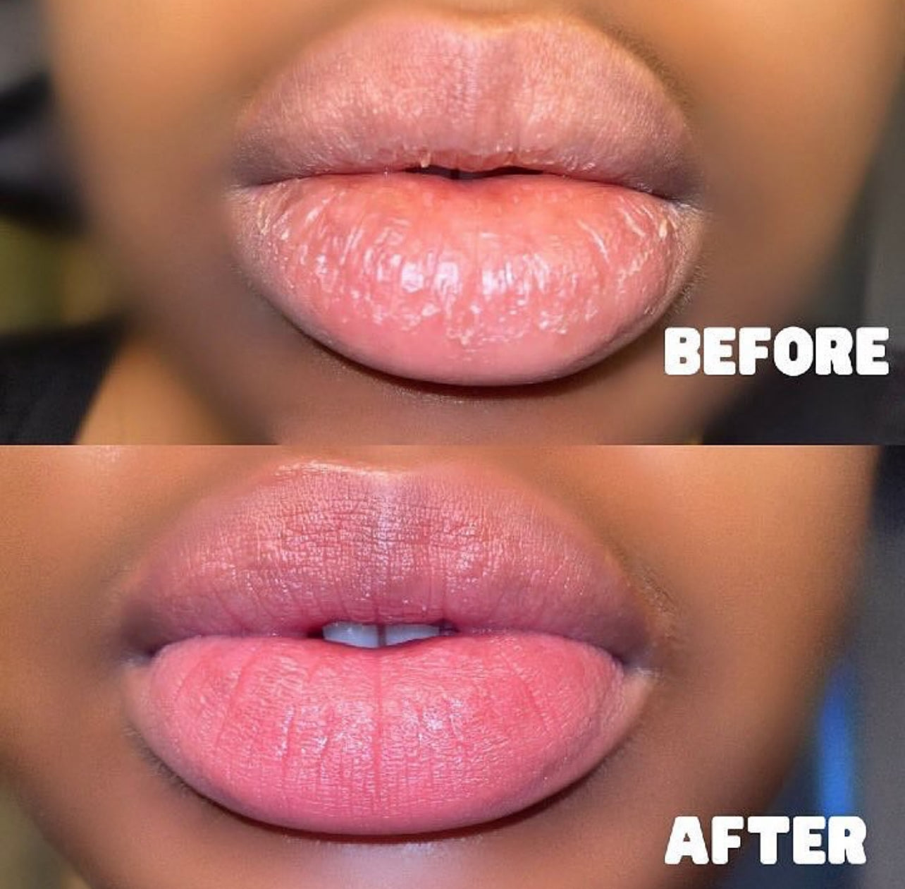 2-in-1 Brightening Watermelon Lip Scrub