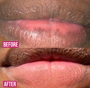 Permanent Pink Lips Balm (100% Effective)