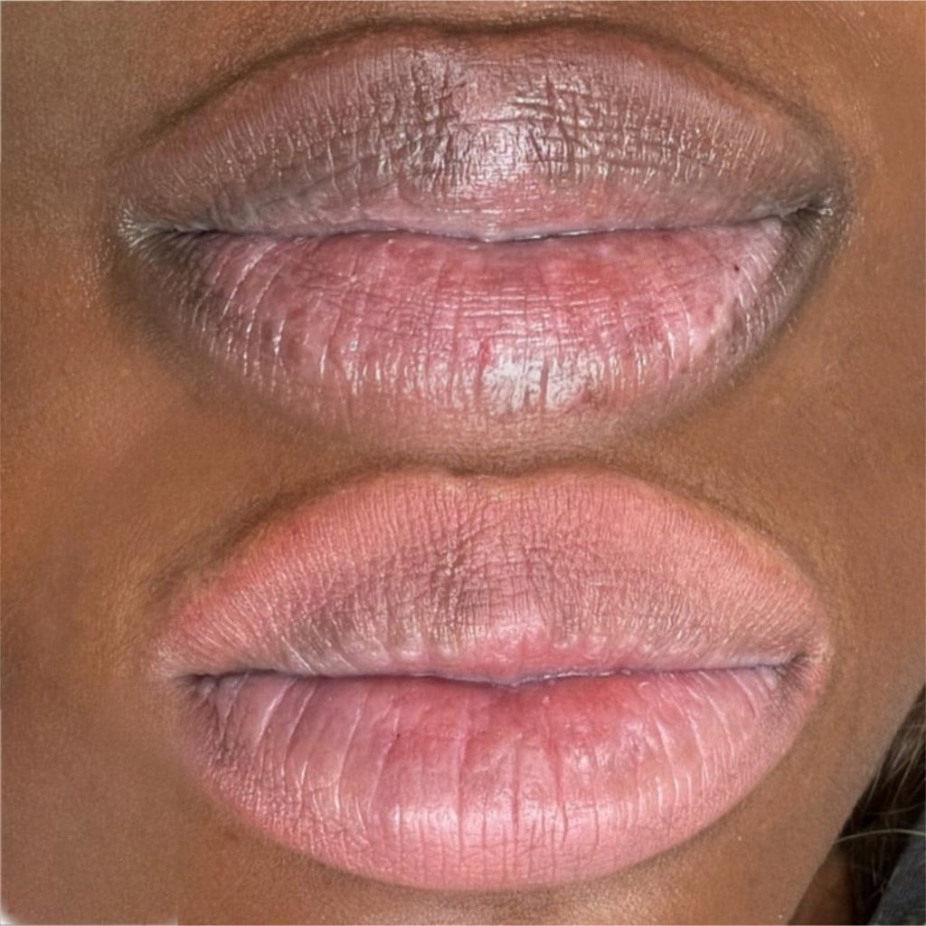 Permanent Pink Lips Balm (100% Effective)