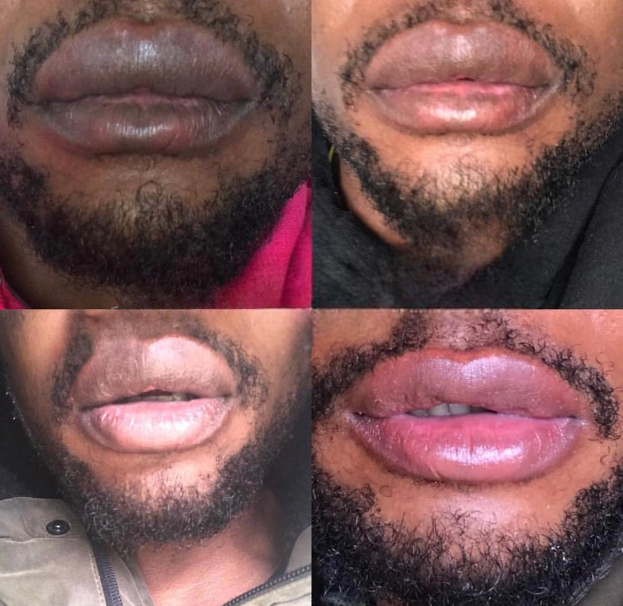 Permanent Pink Lips Balm