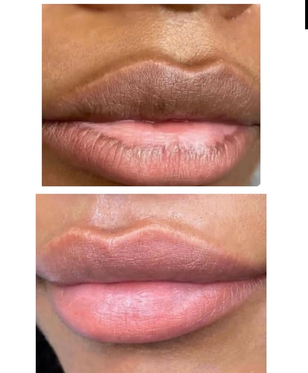 Sugar Rush™️ Brightening Pink Lip Scrub Bundle