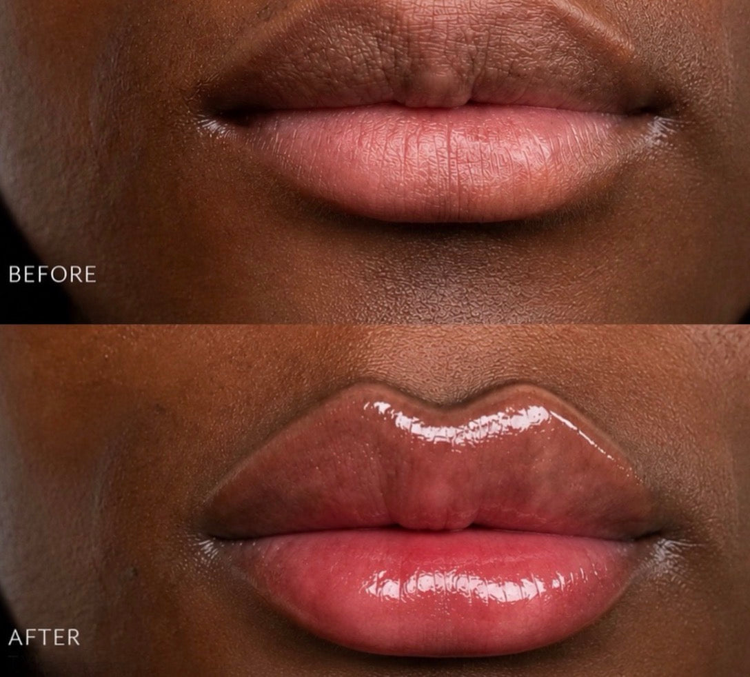 Extreme Lip Plumper