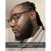 24K Gold Hair & Beard Growth Oil Serum