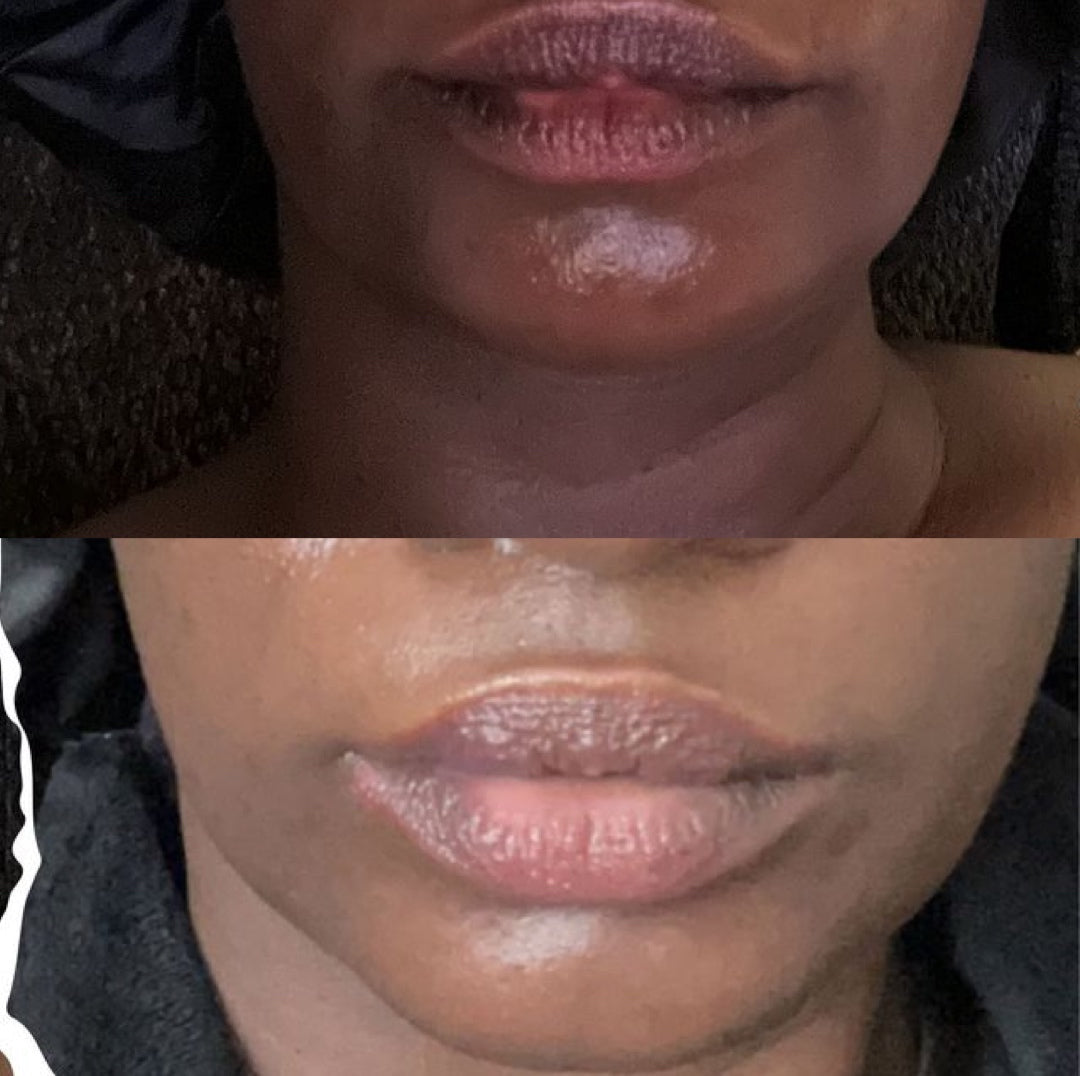 Pink Lips Repair Balm for Dark Lips