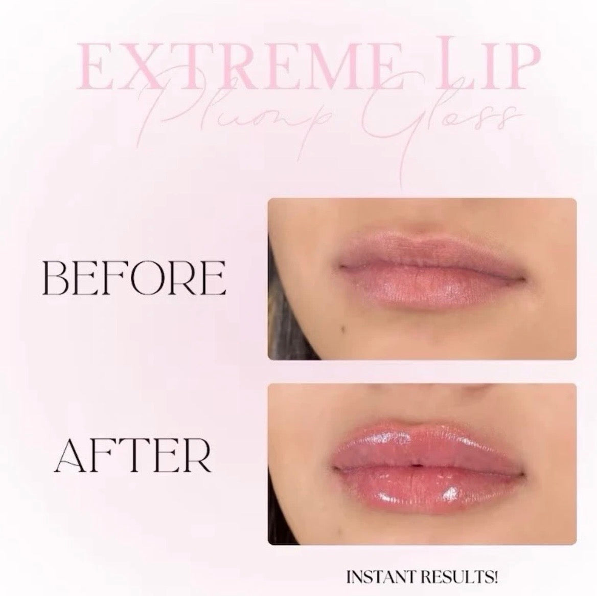 extreme lip plumper