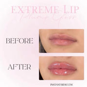 extreme lip plumper