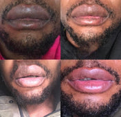 Permanent Pink Lips Balm (100% Effective)
