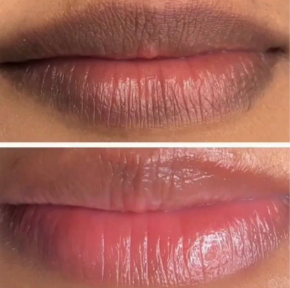 Permanent Pink Lips Balm (100% Effective)