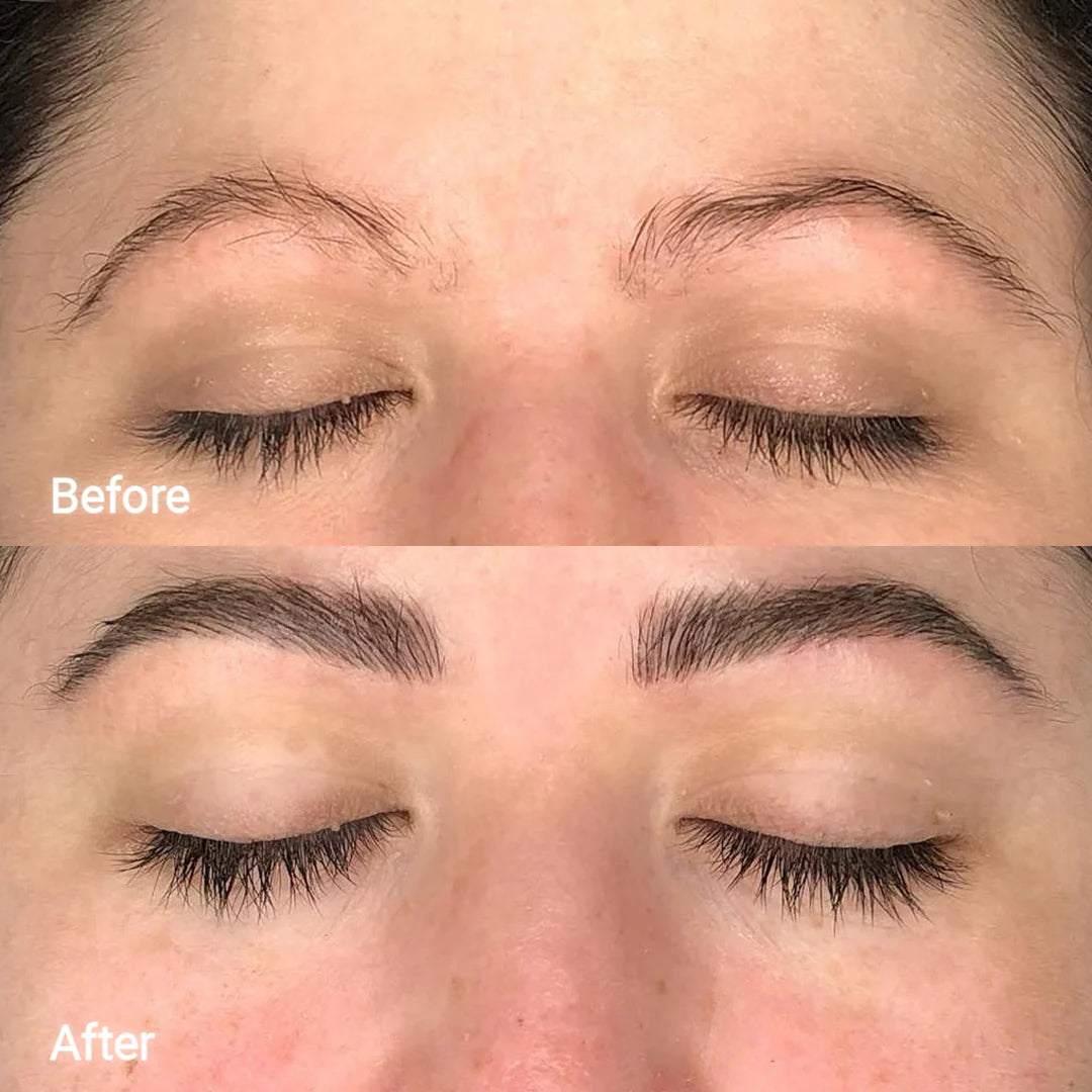 Eyelash & Eyebrow Growth Serum
