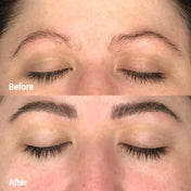 Eyelash & Eyebrow Growth Serum