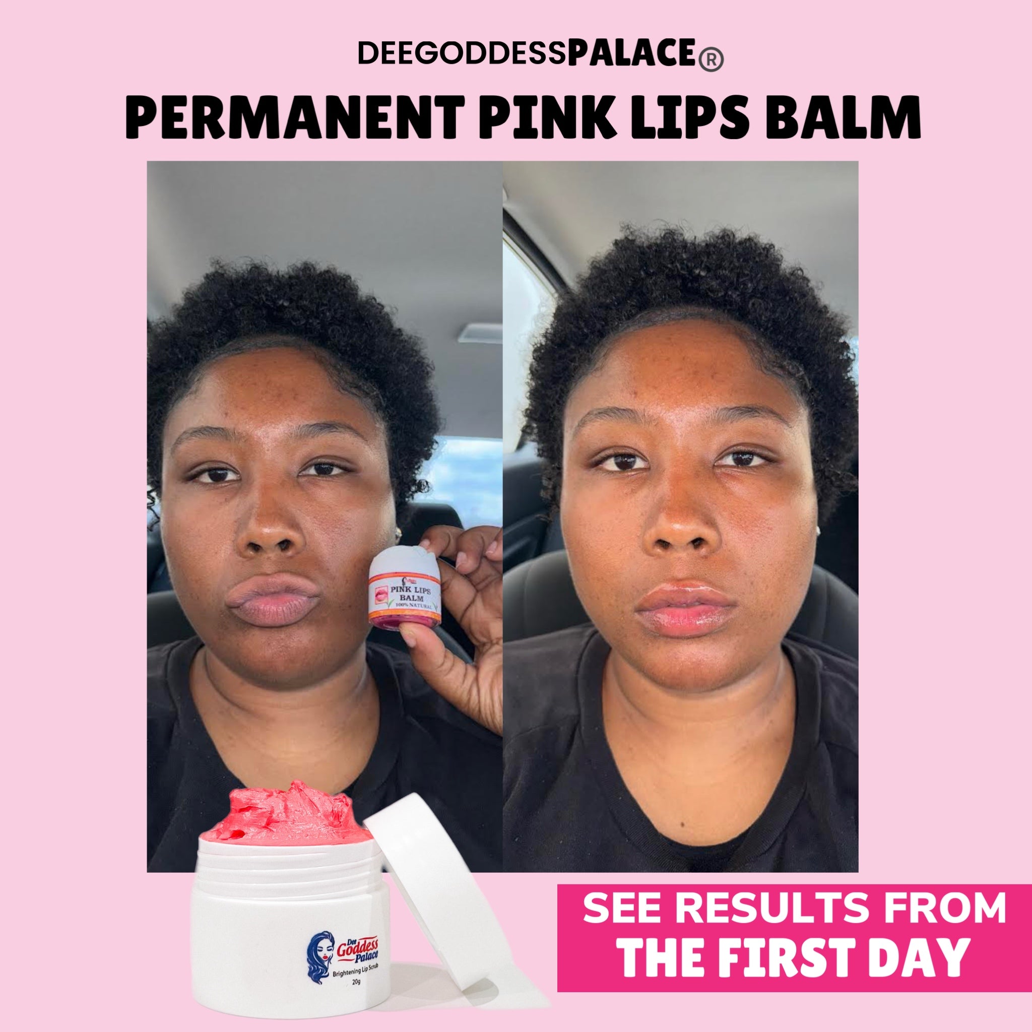 Permanent Pink Lip Kit (100% Effective)