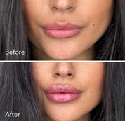 LIP PLUMPER