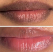 Pink Lips Repair Balm for Dark Lips
