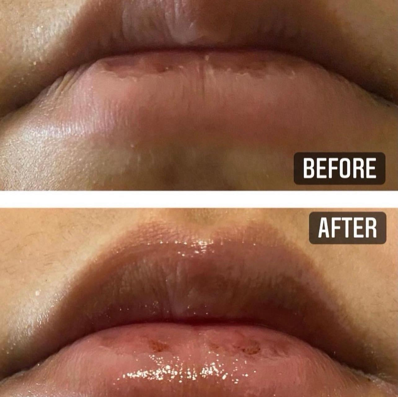 Dreamy Lip Gloss