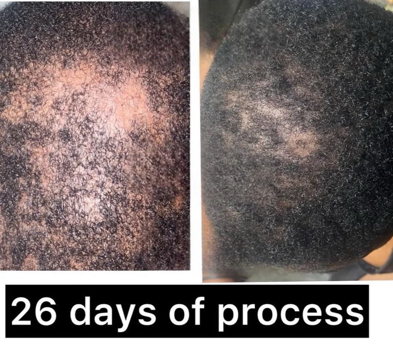 24K Gold Hair & Beard Growth Oil Serum