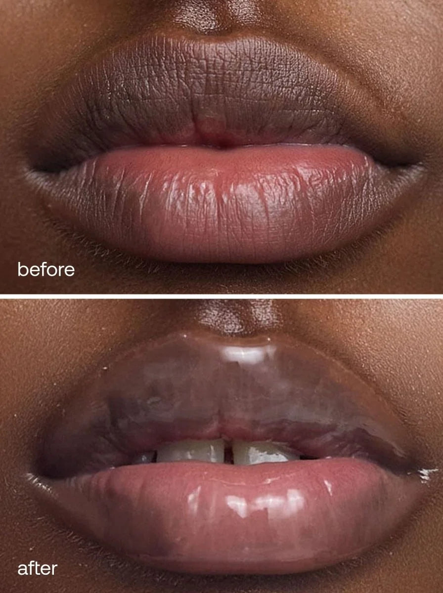 Shea™ Lip Butter Balm