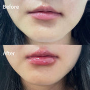 LIP PLUMPER