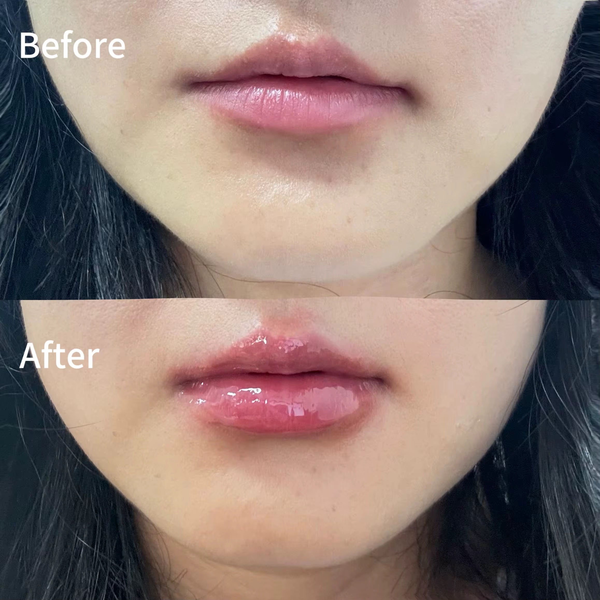 LIP PLUMPER