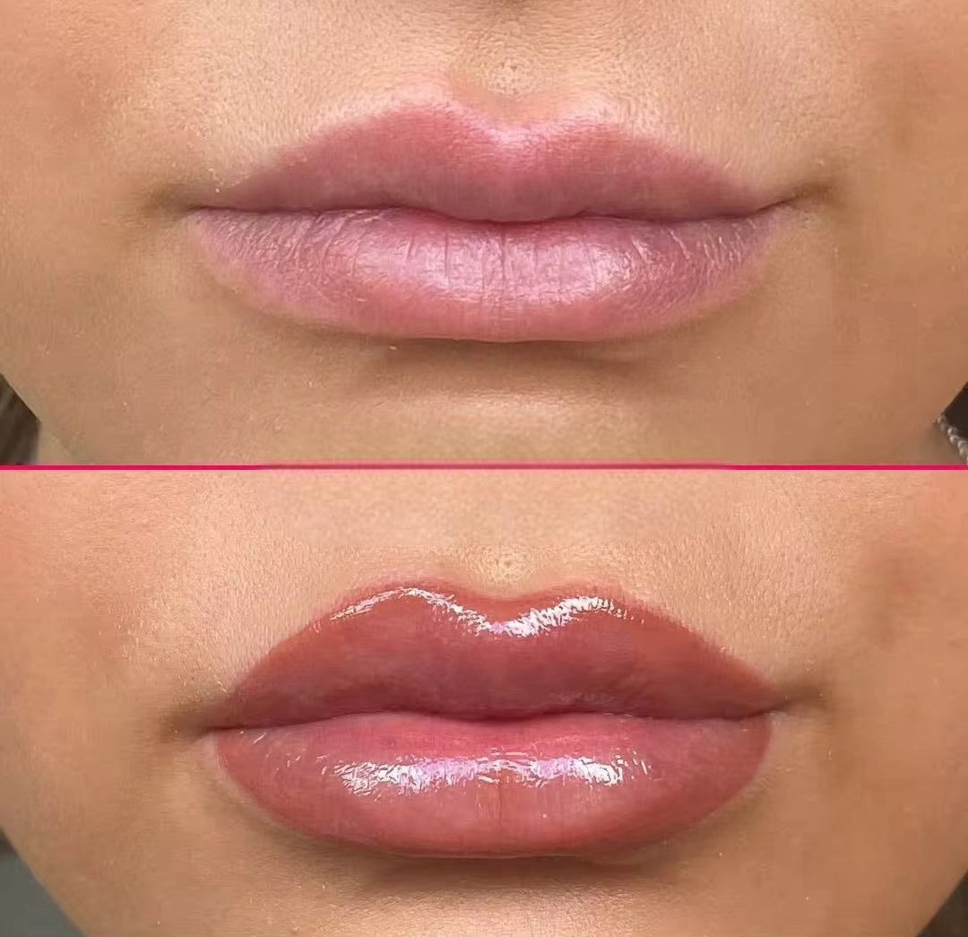 extreme lip plumper