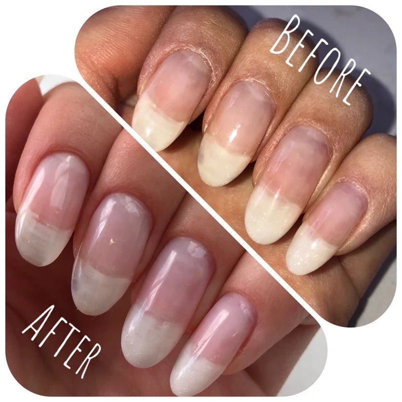 Nail Growth and Cuticle Oil
