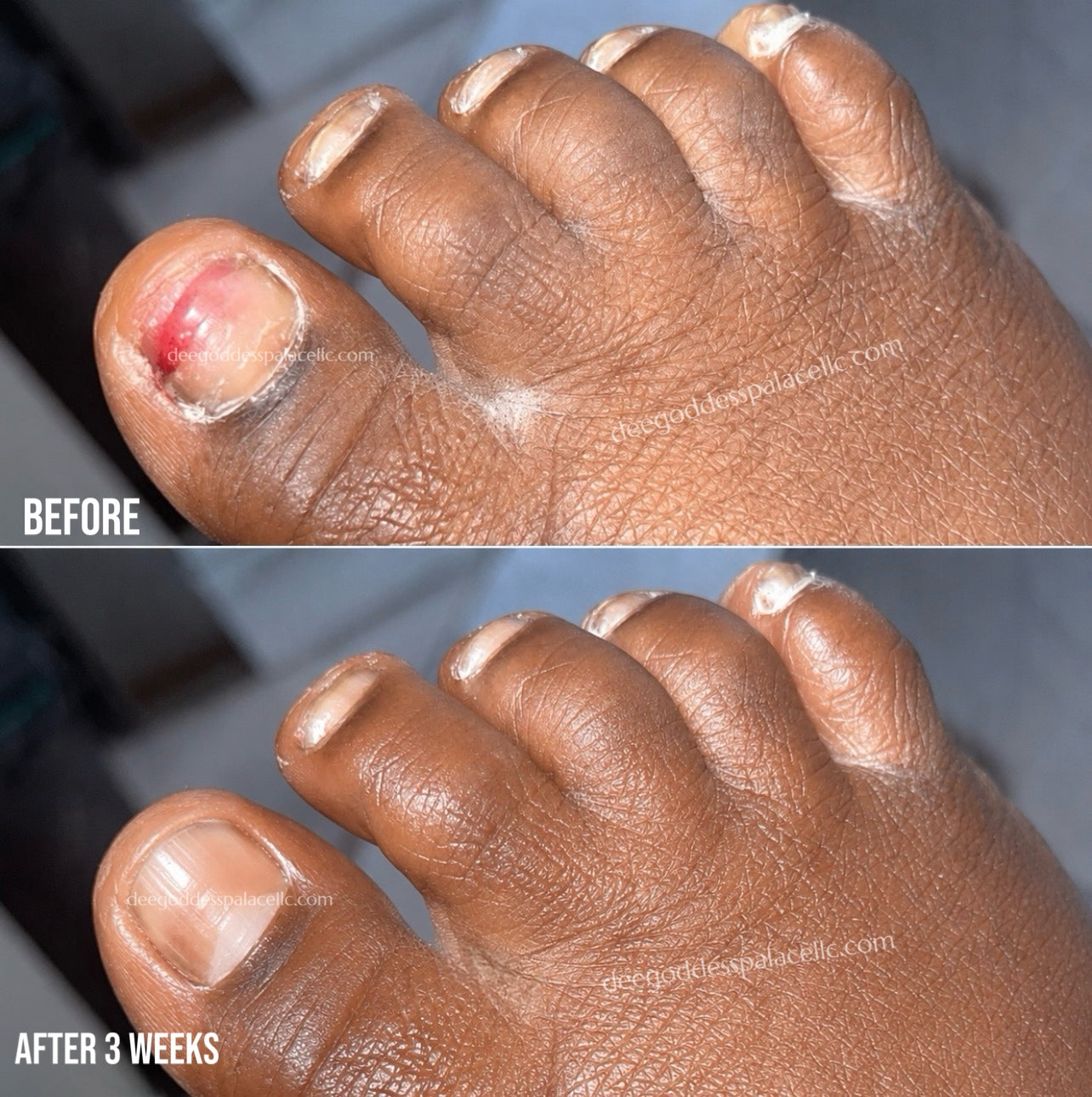Nail Growth & Cuticle Oil Pen