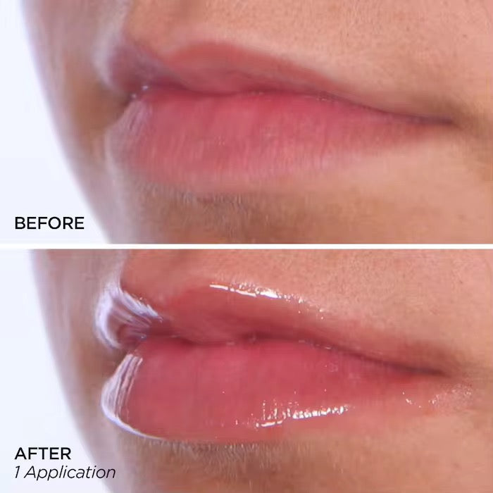 20ML 2% EXTREME LIP PLUMPER