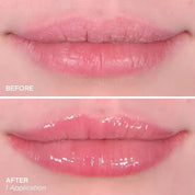extreme lip plumper