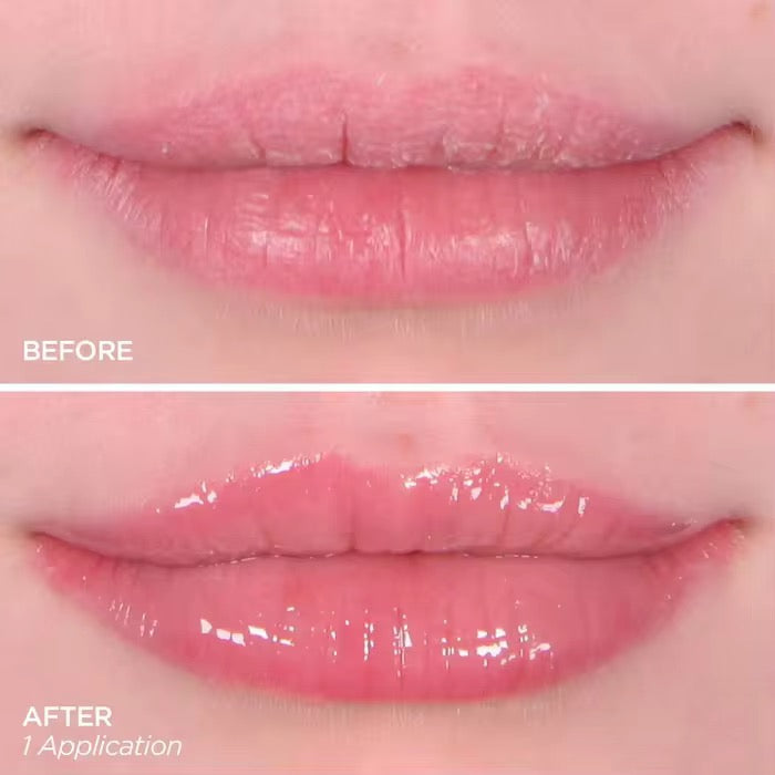 extreme lip plumper