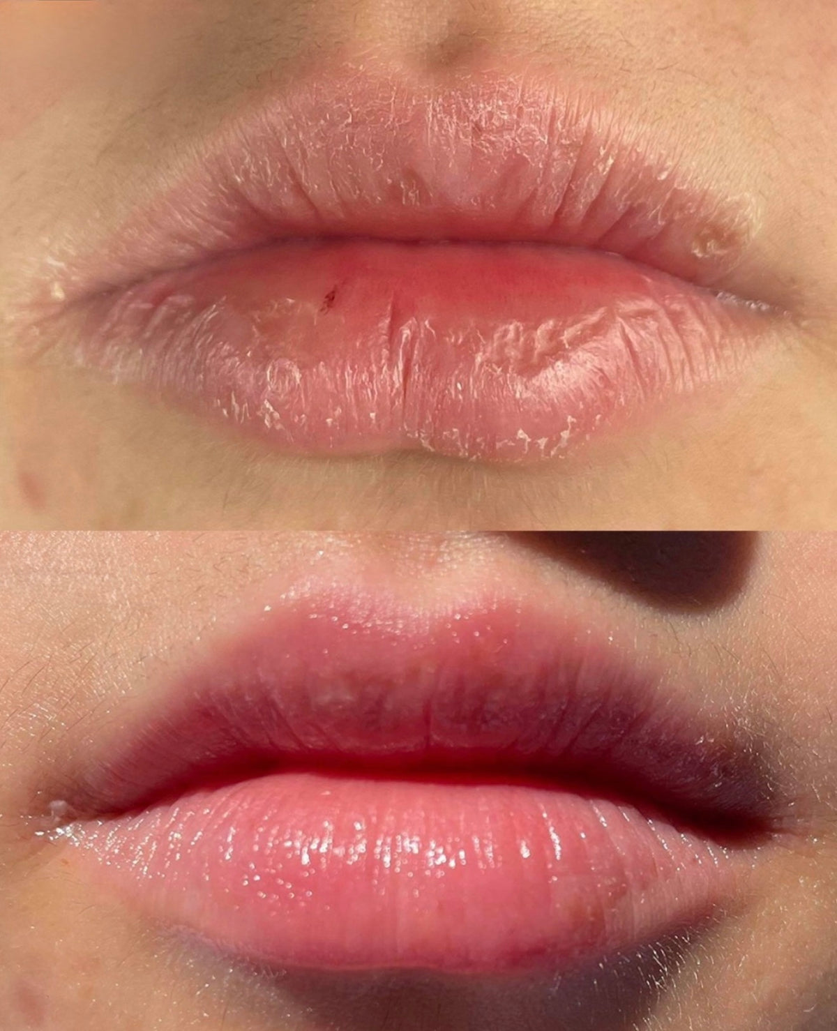 Lip Oil Serum