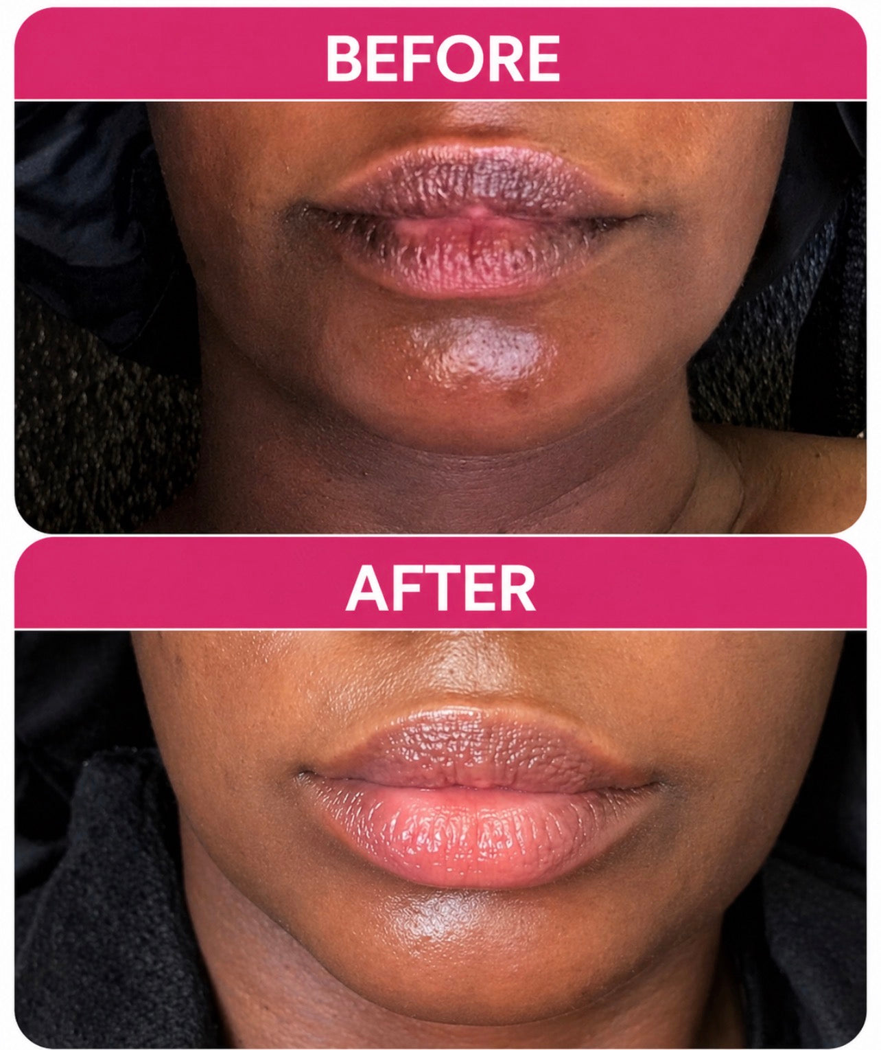 Sugar Rush™️ Brightening Strawberry Pink Lip Scrub