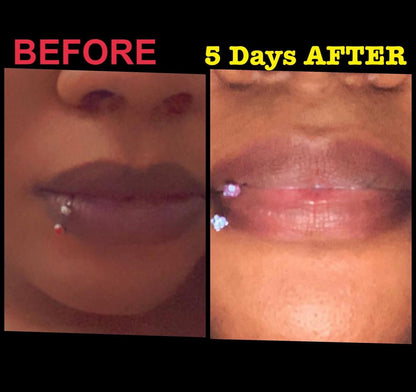 Permanent Pink Lips Balm (100% Effective)